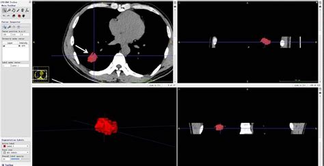 Frontiers Correlation Analysis Between Unenhanced And Enhanced Ct