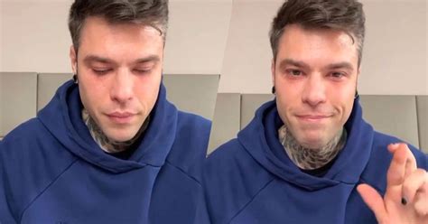 Fedez è Stato Operato Allospedale San Raffaele Di Milano