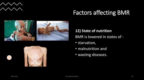 Basal metabolic rate (BMR)- Factors affecting BMR, measurement and cl…