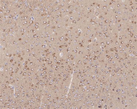 Amyloid Beta A4 Precursor App Recombinant Rabbit Monoclonal Antibody