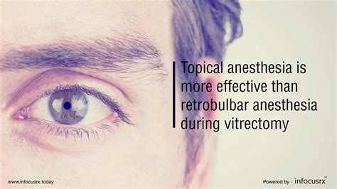 Topical Anesthesia Is More Effective Than Retrobulbar Anesthesia During