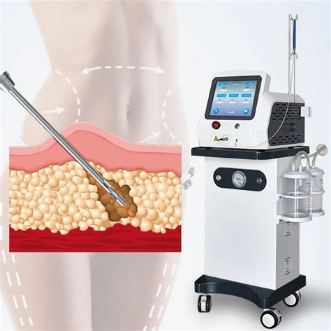 W Nm Diode Laser Lipolysis Liposuction Machine Plastic Surgery