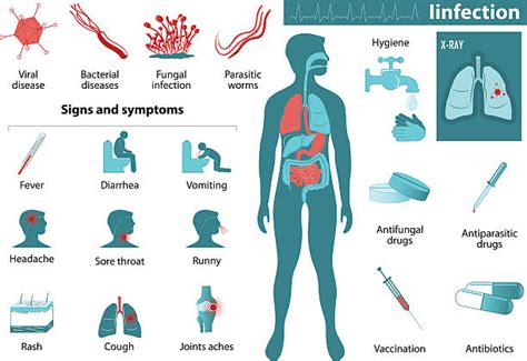 Infectious Disease Clip Art Vector Images And Illustrations Istock