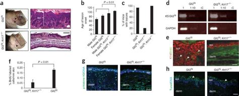 Keratin Promotes Epithelial Proliferation And Tumor Growth By