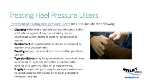 Heel Pressure Ulcer Stages