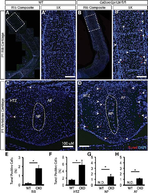 Col Cre Gpr Fl Fl Mutant Cartilage Displays Increased Apoptosis