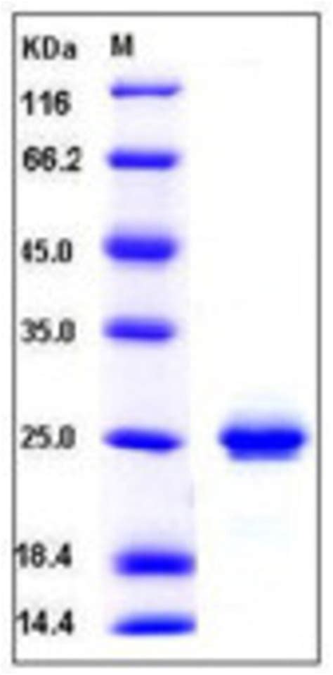 Sino Biological Human Cd A Fcgr A Protein Arg His Tag