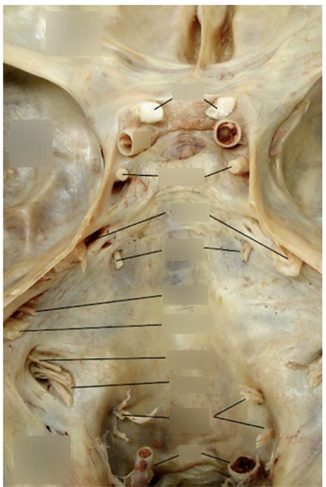 Cavernous Sinus Cranial Nerves Diagram Diagram Quizlet