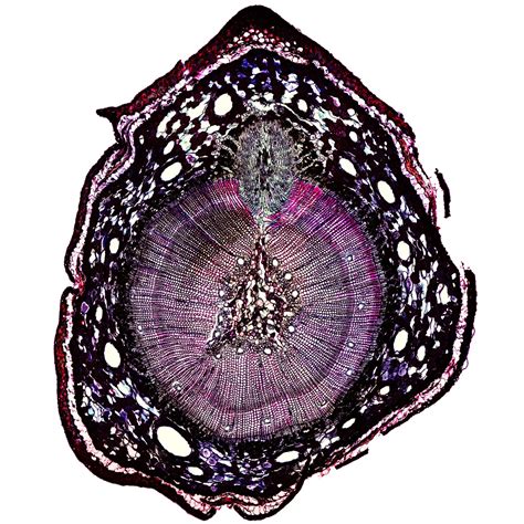 Pine Stem Cross Section 25 Exposures From A Digital Microscope 40x