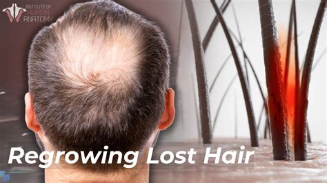 The Science Of Hair Loss How To Prevent And Regrow Lost Hair Youtube