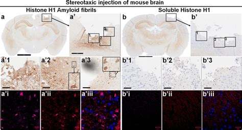 Amyloid Fibrillar But Not Soluble Histone H Can Induce S