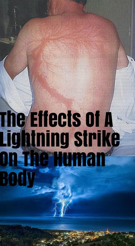 The Effects Of A Lightning Strike On The Human Body Lightning Strikes