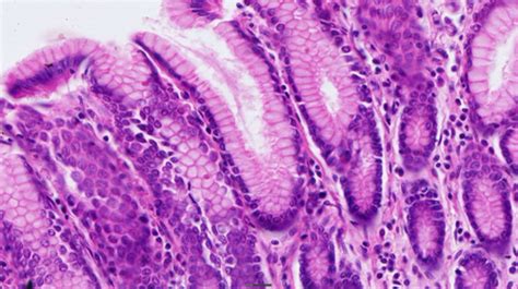 Histology Epithelium Lab Flashcards Quizlet