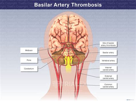 Basilar Artery Pons