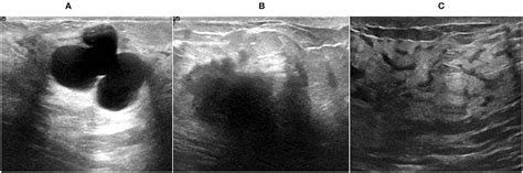 Frontiers Breast Cancer Detection And Classification Empowered With