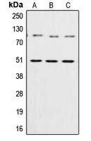 Anti-NFKB1 / NF-Kappa-B Antibody | Rabbit anti-Human Polyclonal | LSBio 