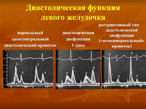 Лучевая диагностика заболеваний миокарда и перикарда