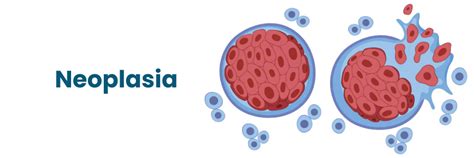 What Is Neoplasia and How Is It Treated?