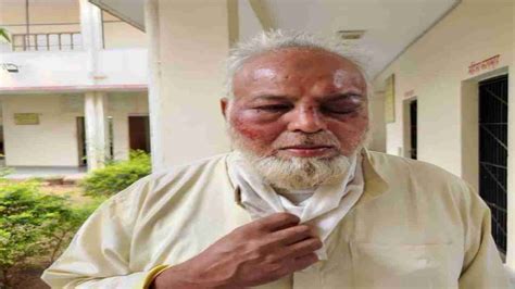 Rajasthan Muslim Auto Driver Beaten Up Forced To Chant Jai Shree Ram