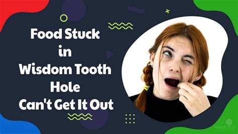 How To Get Rid Of Food Stuck In Wisdom Tooth Hole