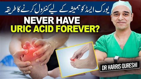 Never Have Raised Uric Acid Ever Uric Acid Test Symptoms Treatment