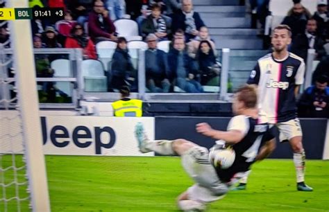 Moviola Juventus Bologna De Ligt Tocca Di Braccio Perché Arbitro E