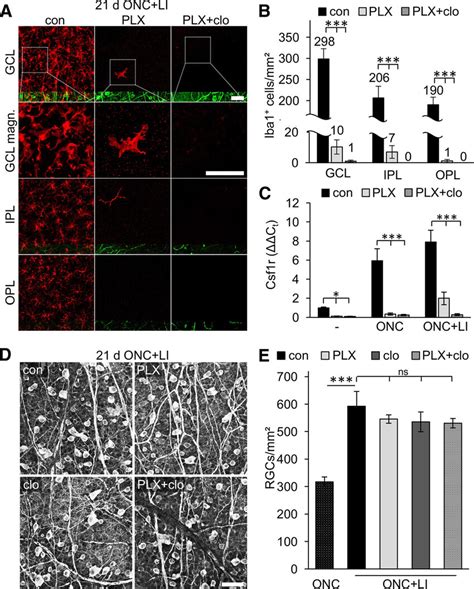 Microglia And Infiltrating Macrophages Have No Impact On The Survival