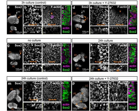 Effects Of The Rock Inhibitor Y 27632 On The Segregation Of The Download Scientific Diagram