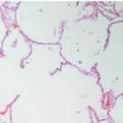 Hemosiderin deposits in the spleen red pulp. Perls's stain, 200× ...