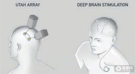 与ai共生：马斯克neuralink的脑机接口梦 芬莱科技 提供vr Ar虚拟现实一站式解决方案