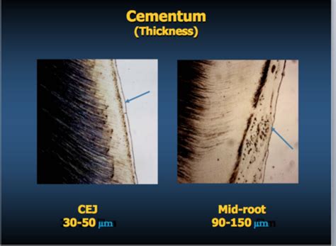 Test Cementum Flashcards Quizlet