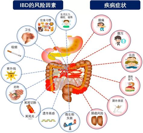 你以为就是简单的拉肚子其实是炎症性肠病 澎湃号湃客 澎湃新闻 The Paper