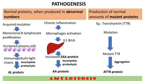 Amyloidosis Part 2 Pathogenesis And Classification Pathology Made Simple