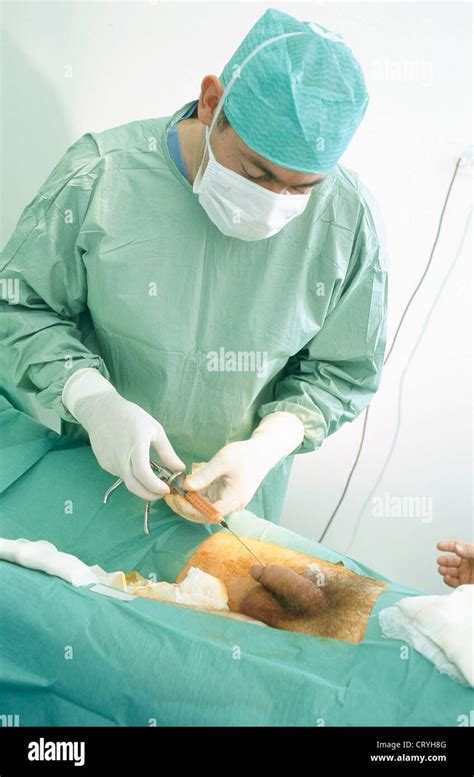 La Chirurgie En Plastique Sur Un PÉnis Photo Stock Alamy