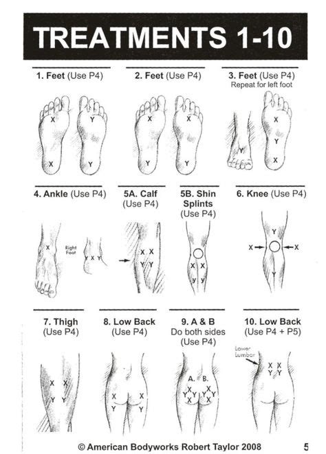 Tens Unit Placement Diagram