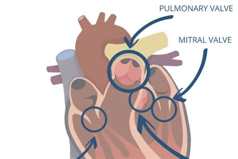 Learn Eliquis And Artificial Heart Valves Dont Mix