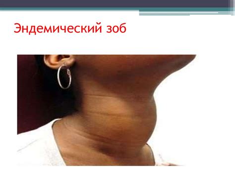 Болезни связанные с характером питания - презентация онлайн