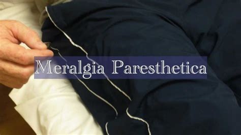 Meralgia Paresthetica Causes, Symptoms, Diagnosis and Treatment - Natural Health News