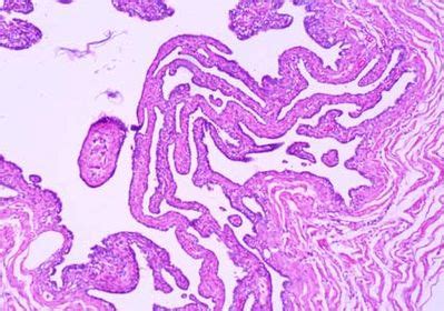 Uterine Tube Slide