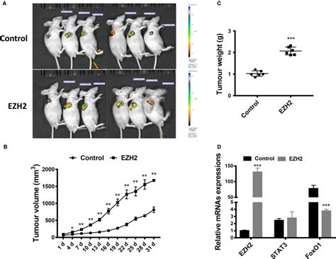 Enhancer Of Zeste Homolog 2 EZH2 Overexpression Promotes Oral