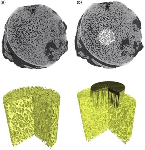 2 Micro Ct 3d Reconstruction Of Femoral Head Bone Specimens A Before