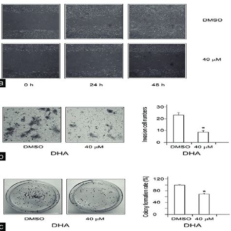 Cell Migration Invasion And Colony Formation A Dha Suppresses