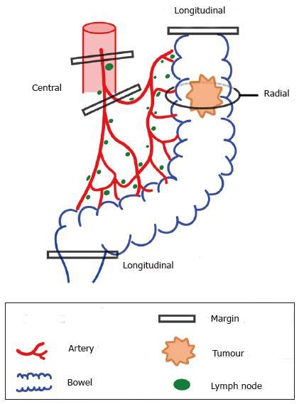 Retroperitoneal Lymph Nodes Anatomy - Anatomy Reading Source