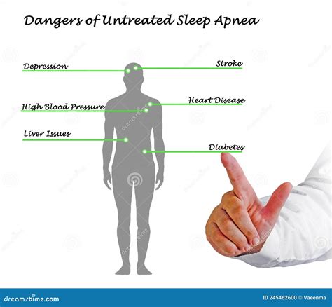 Dangers Of Untreated Sleep Apnea Stock Photo Image Of Pressure Blood