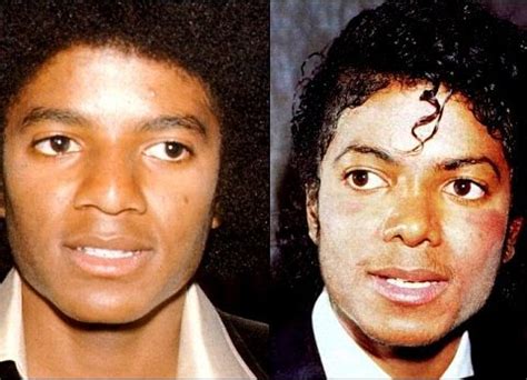 How Did Michael Jackson Change His Skin Color