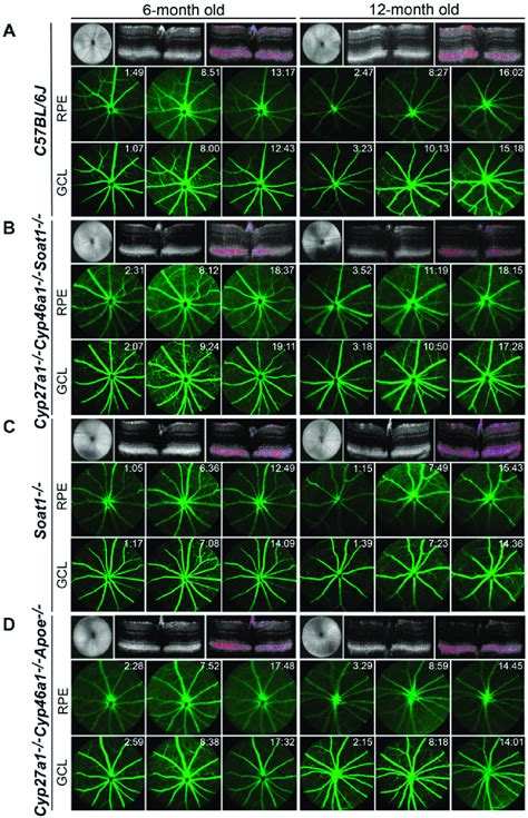 In Vivo Imaging Of 6 And 12 Month Old C57bl6j A Cyp27a1 −− Cyp46a1