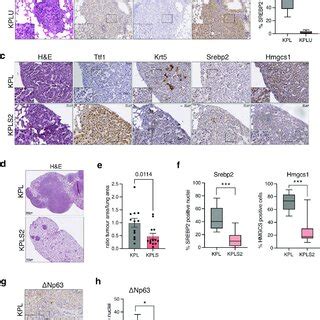 Deletion Of Srebf Attenuates Tumour Formation In A Mouse Model Of Lung