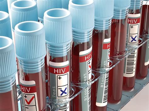 HIV estudo analisa eficácia de tratamento de prevenção Boa Saúde