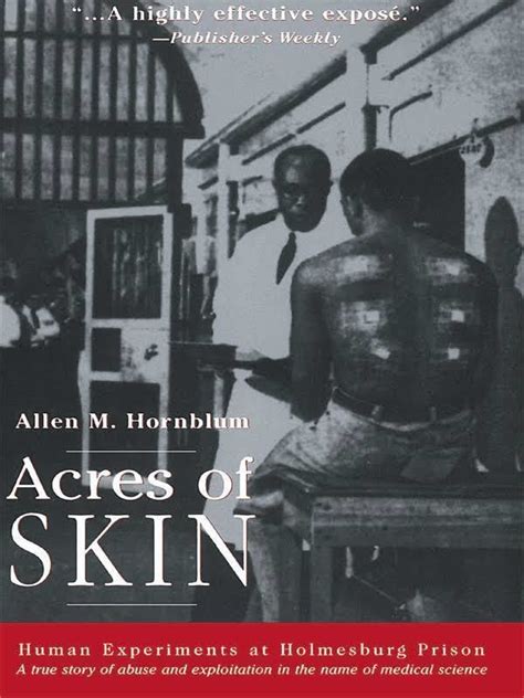 Acres Of Skin Alchetron The Free Social Encyclopedia