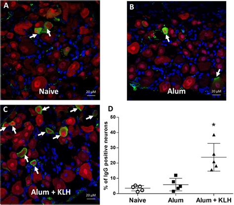 Sensory Neurons Of The Mouse Dorsal Root Ganglia DRGs Exhibit